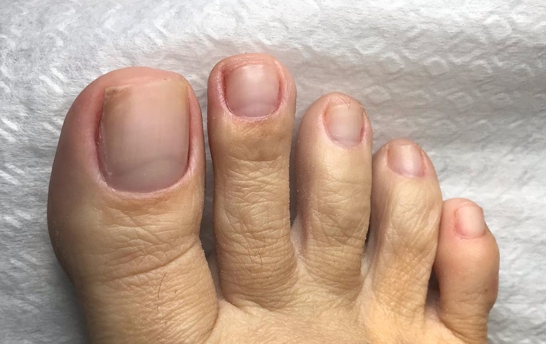 Karin Klemp's toes