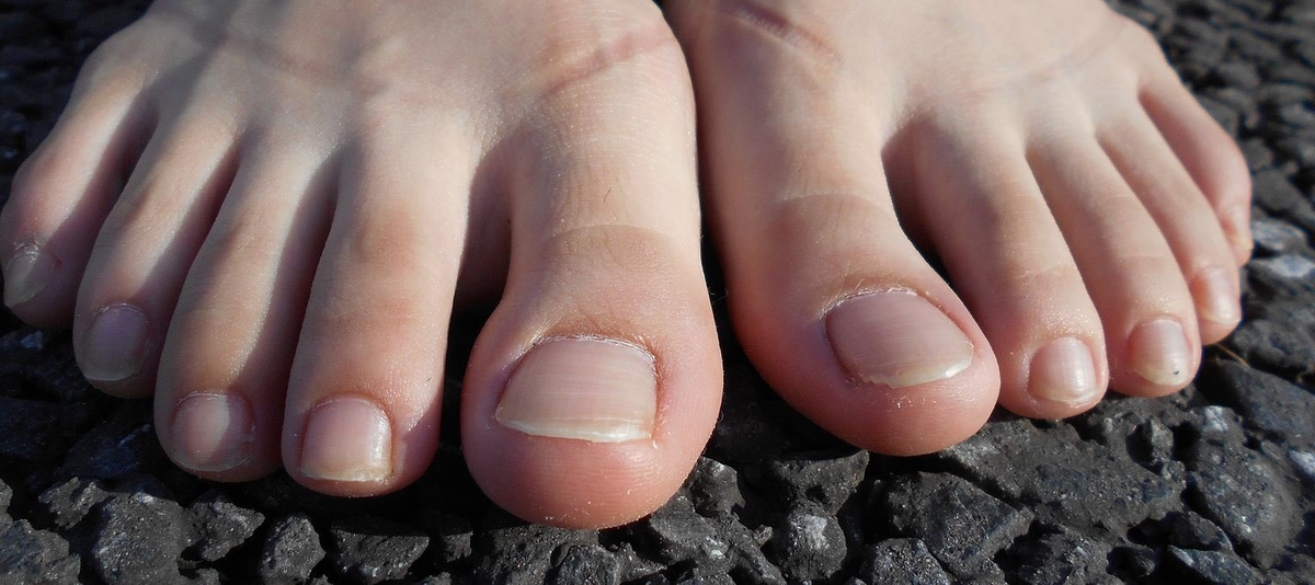 a girl showing her toes