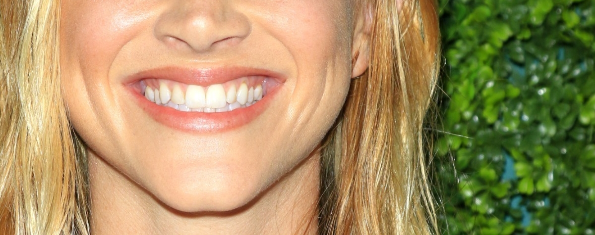 Emily Wickersham's lips and teeth