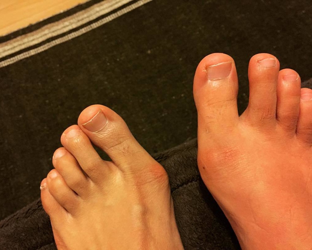 Aparna Nancherla's toes