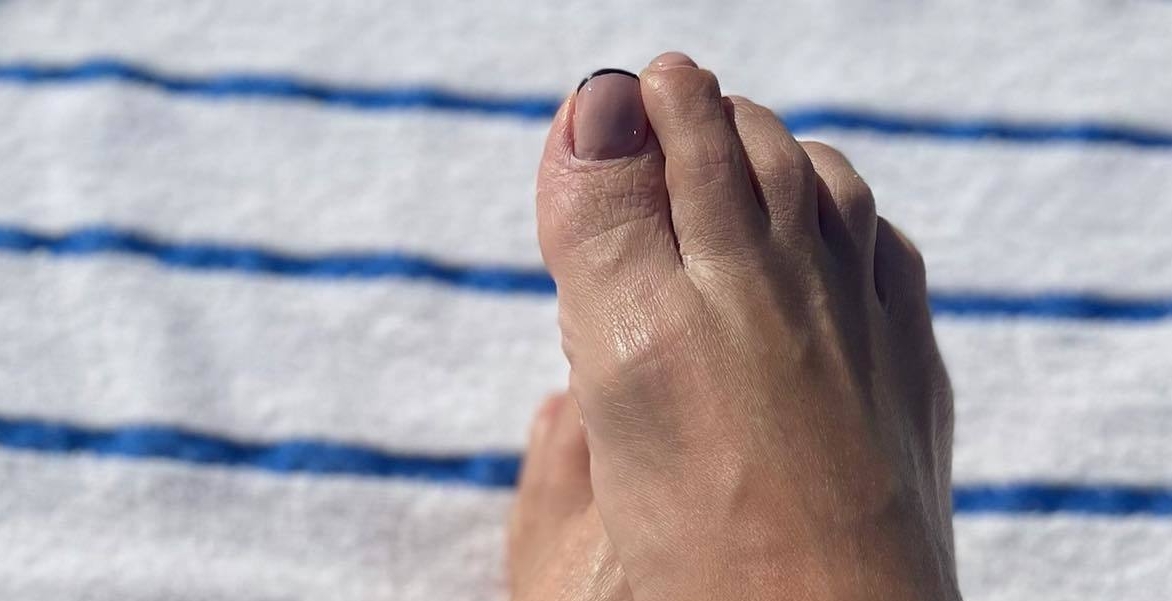 Adriana Fonseca's toes