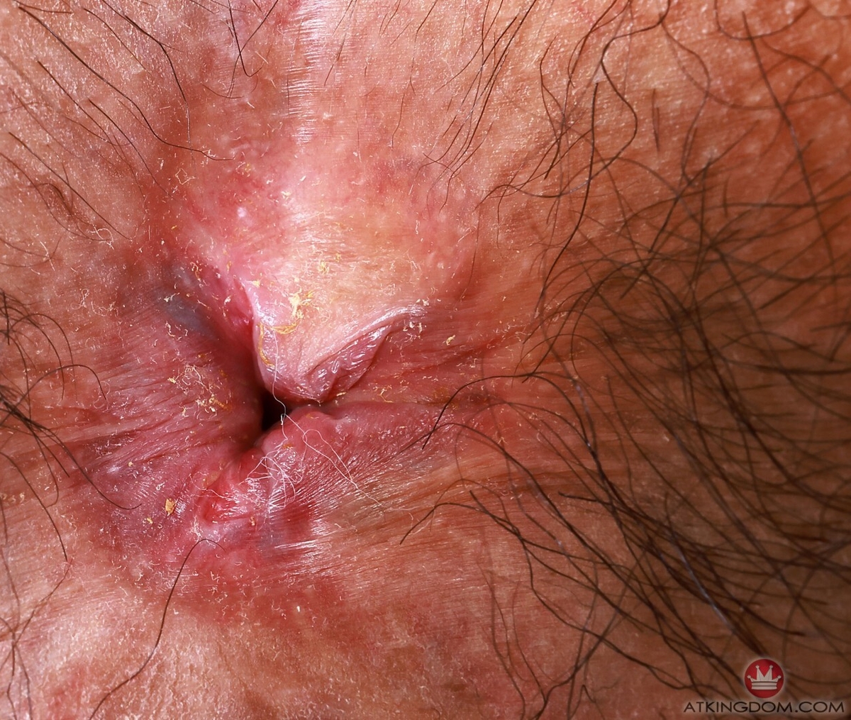 Hazel Heart's asshole