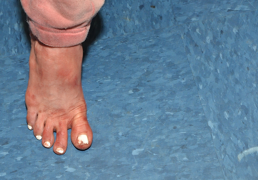 Courtney Clenney's foot after allegedly stabbing her boyfriend to death