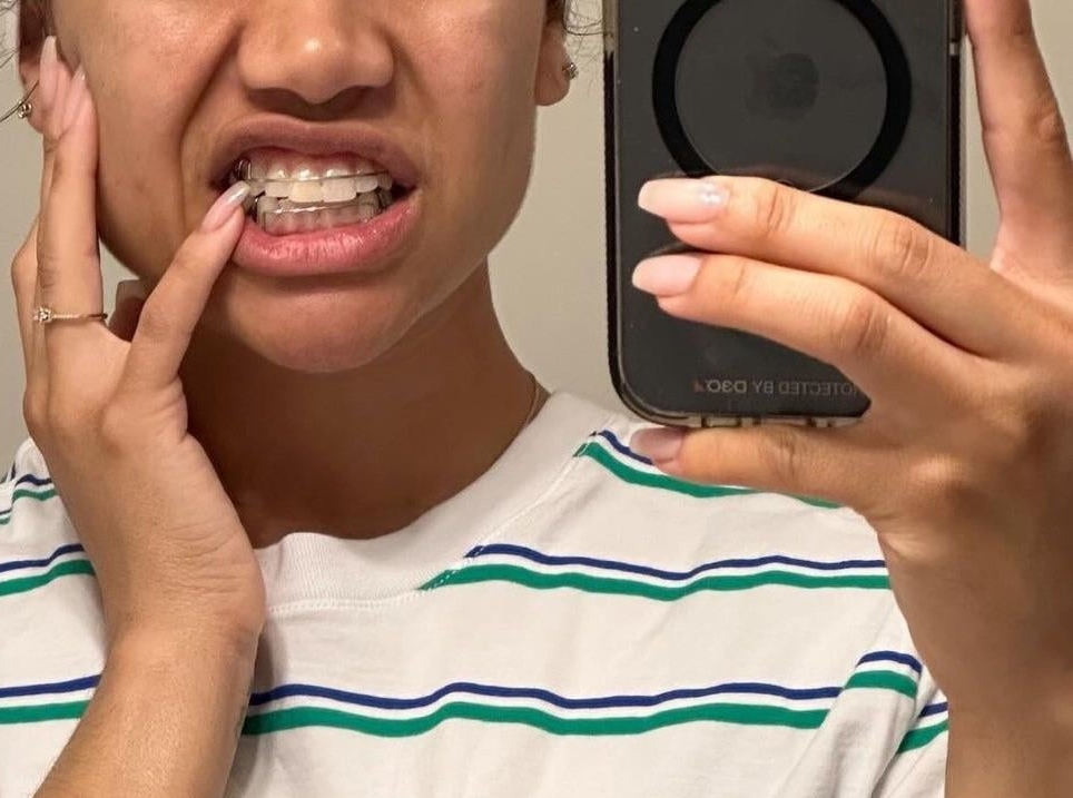 Paige Hurd showing her braces