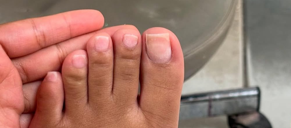 Supa Peach's toes