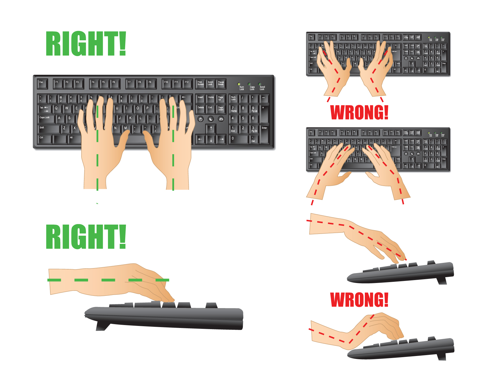 illustrations showing right and wrong desktop keyboard and mouse hand posture