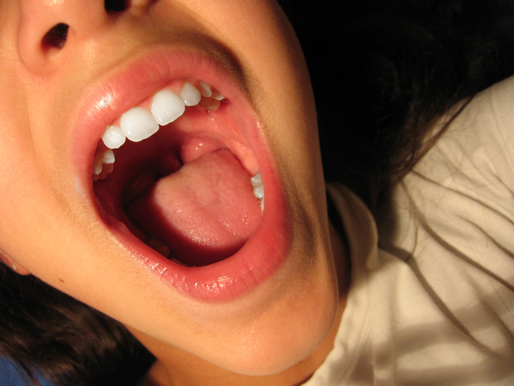 a kid showing the inside of her mouth