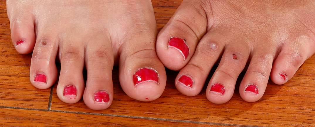 Michelle Martinez's toes