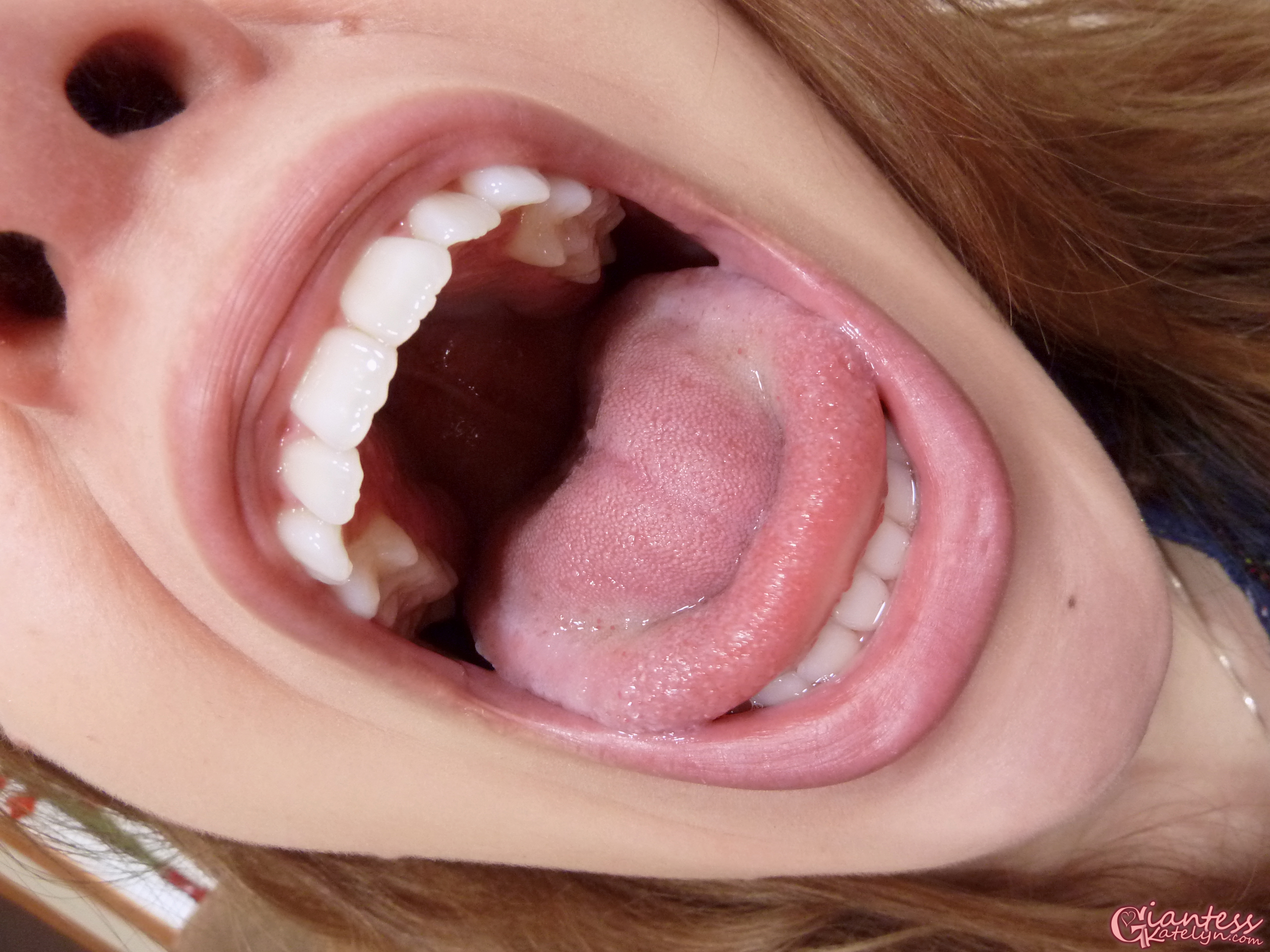 Katelyn Brooks showing the inside of her mouth.