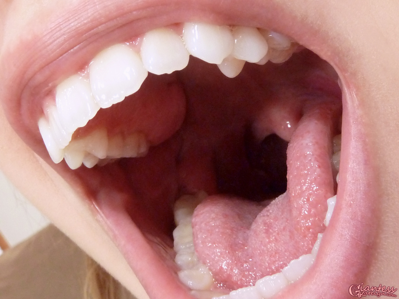 Katelyn Brooks showing the inside of her mouth