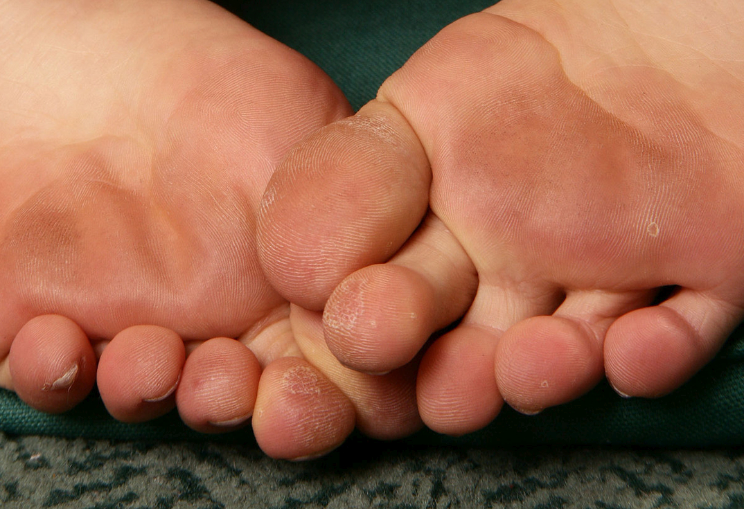 a girl named Miyu showing her toes