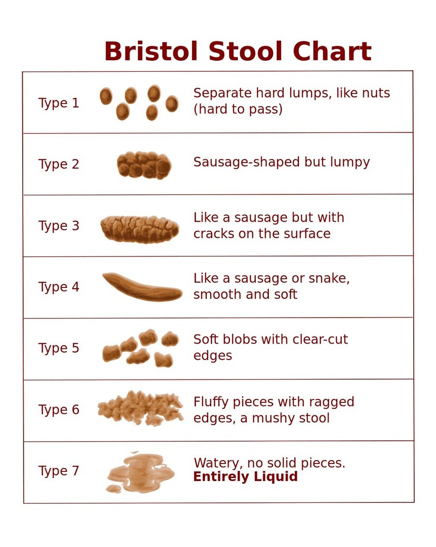 a chart showing types of shit : Bristol Stool Chart