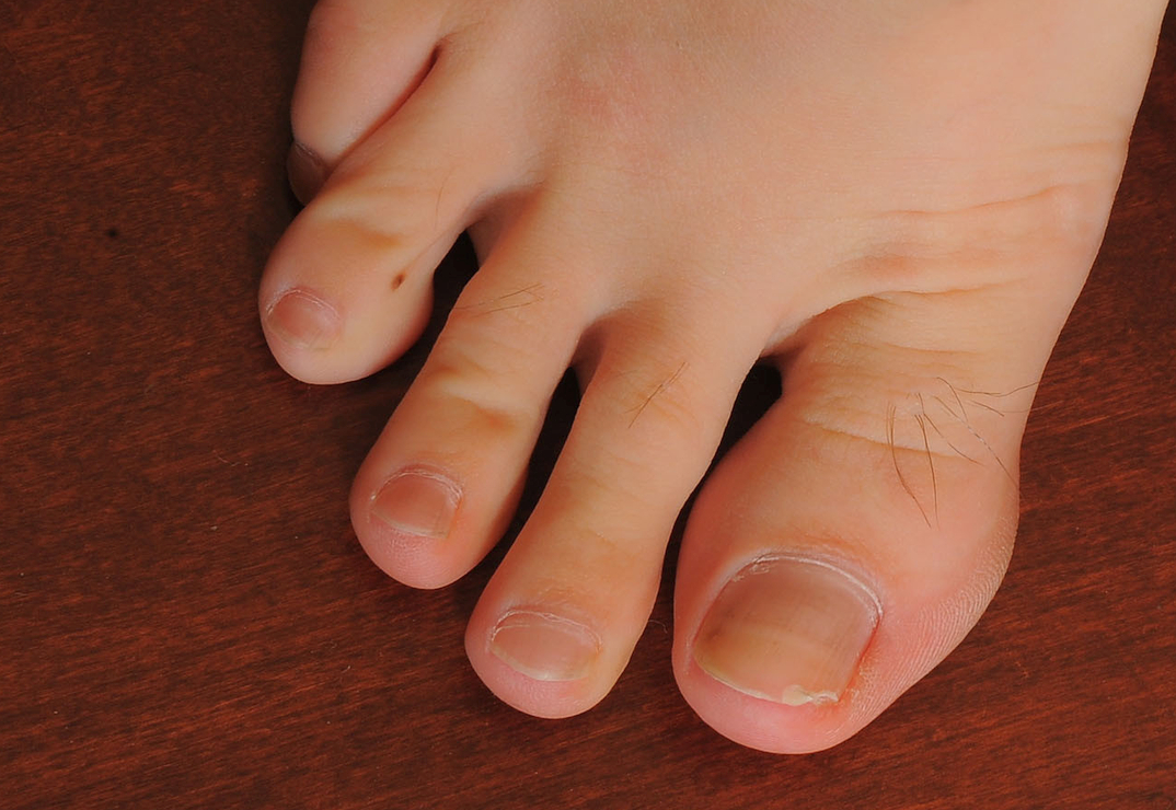 Zoey Kush's toes