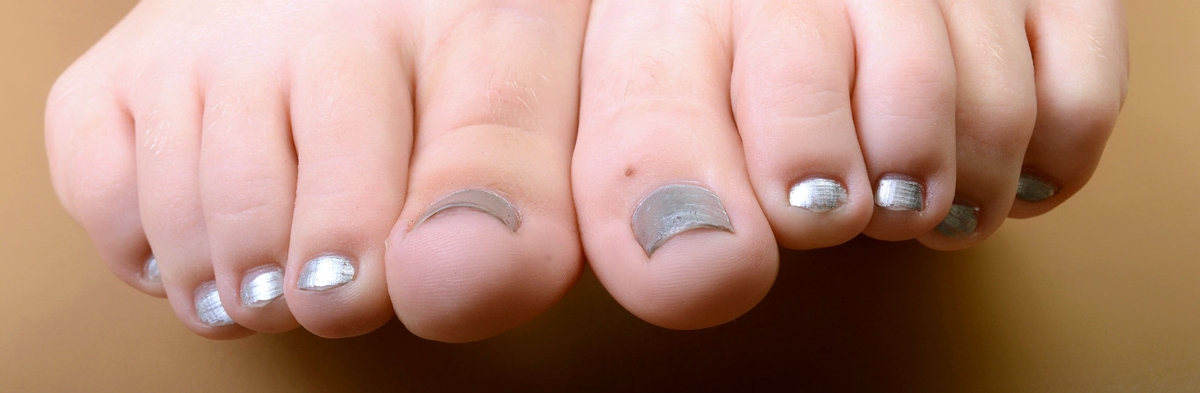 Darcie Belle's toes