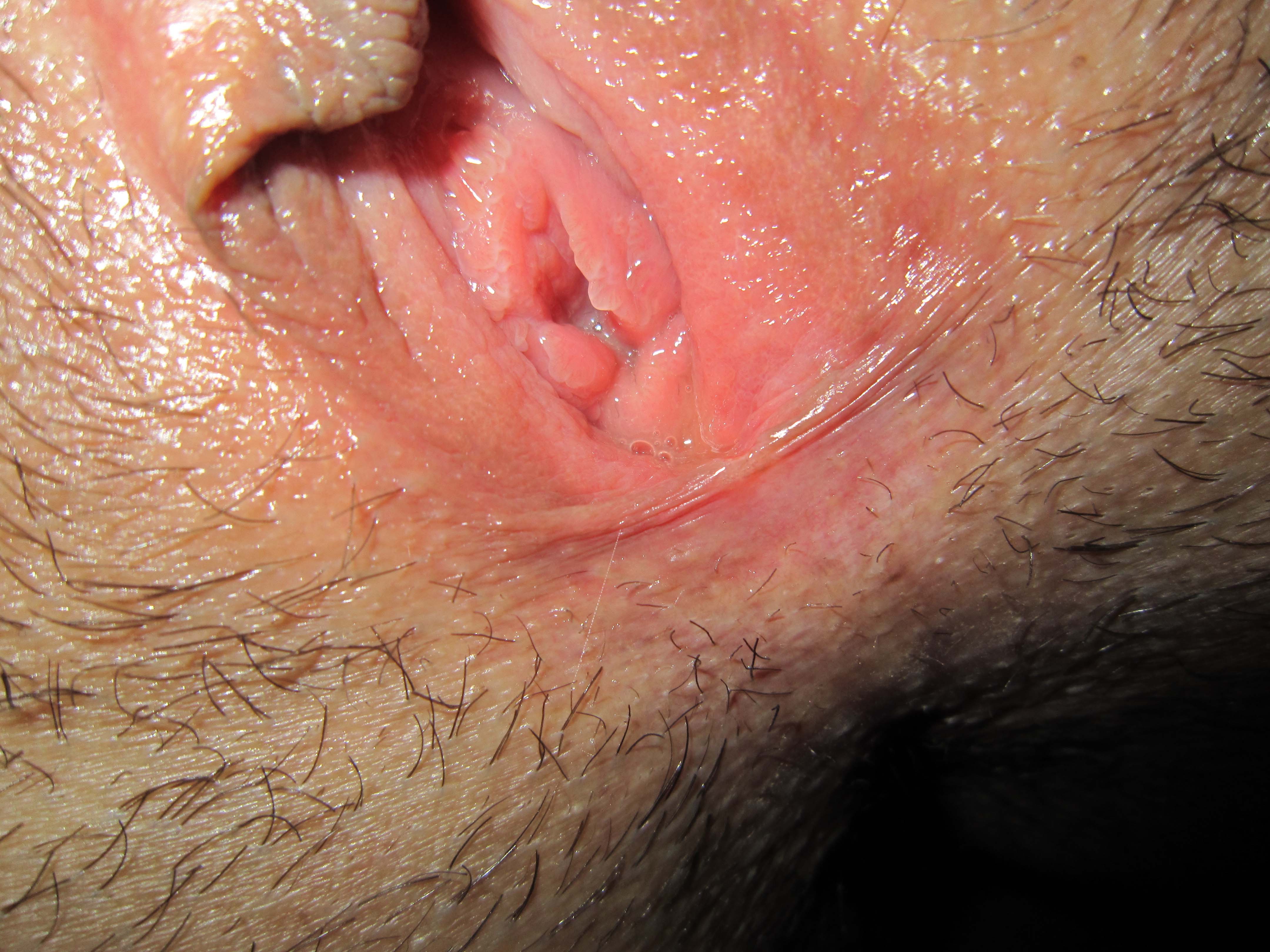 a woman showing her pussy