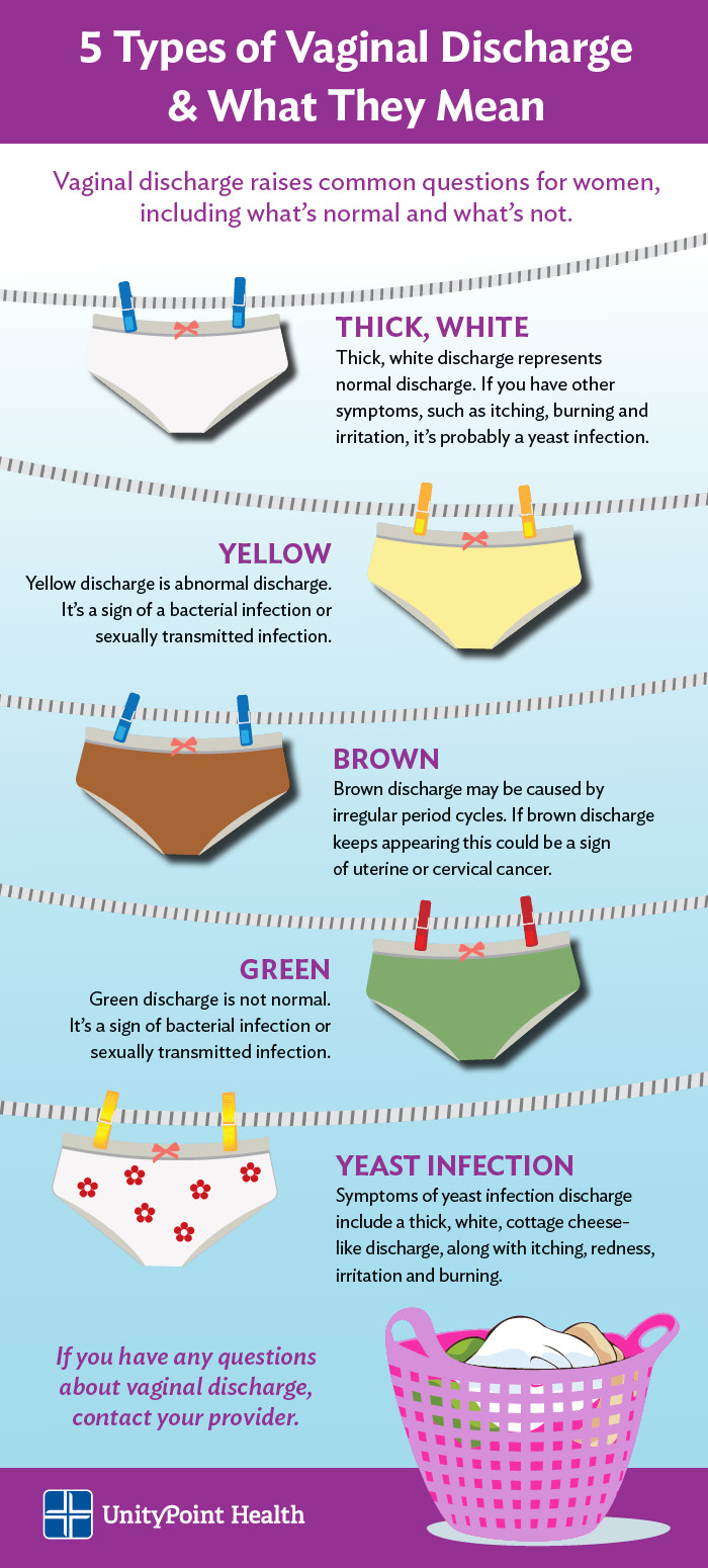 A Unitypoint Health Chart Five Types Of Vaginal Discharge And What They Mean